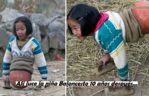 Así luce la niña pelota luego de 10 años. Es millonaria y ya tiene piernas!!