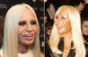 famosos que el cirujano les arruinó la vida.