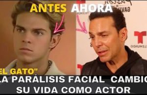 El cambio RADICAL del Actor Juan Alfonso Baptista