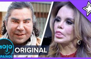 Asi lucen estas terribles Cirugías Plásticas de Famosos